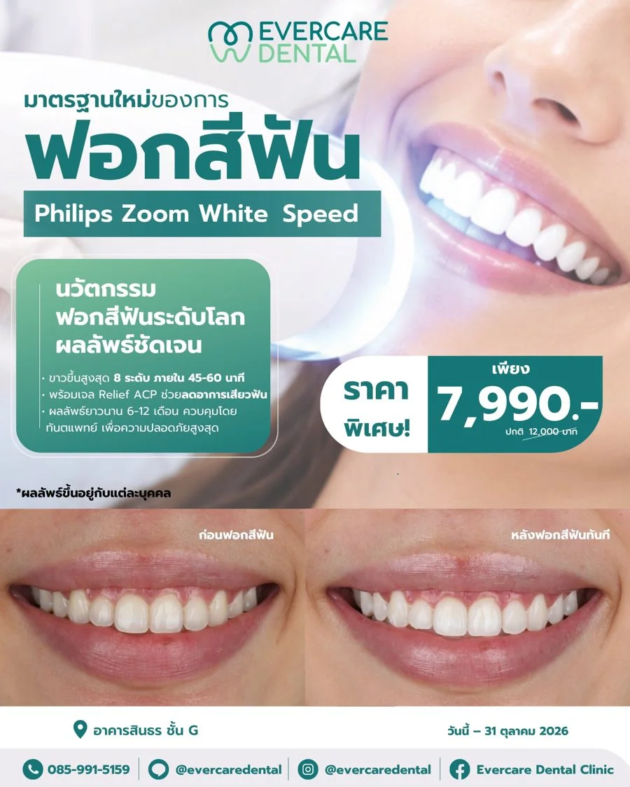 ฟอกสีฟัน Philips Zoom WhiteSpeed ที่ Evercare Dental ขาวขึ้นสูงสุด 8 ระดับ ราคาพิเศษ 7,990 บาท พร้อมภาพก่อน-หลังฟอกสีฟันจริง