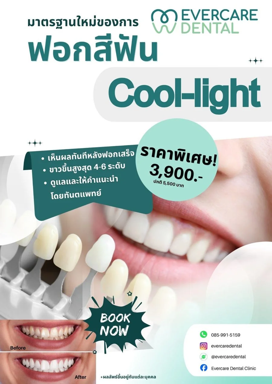 ฟอกสีฟันระบบฉายแสง Pola Cool-light ที่ Evercare Dental ขาวขึ้น 4-6 ระดับ เห็นผลทันทีหลังทำ