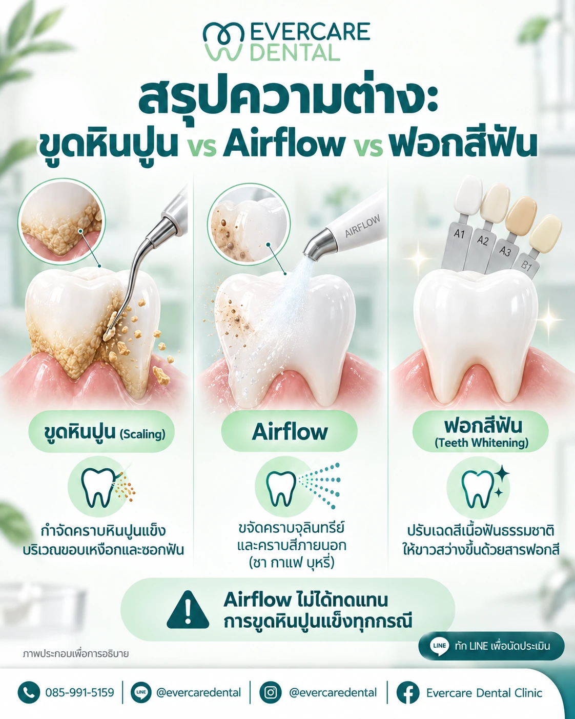 เปรียบเทียบเป้าหมายของขูดหินปูน Airflow และฟอกสีฟัน