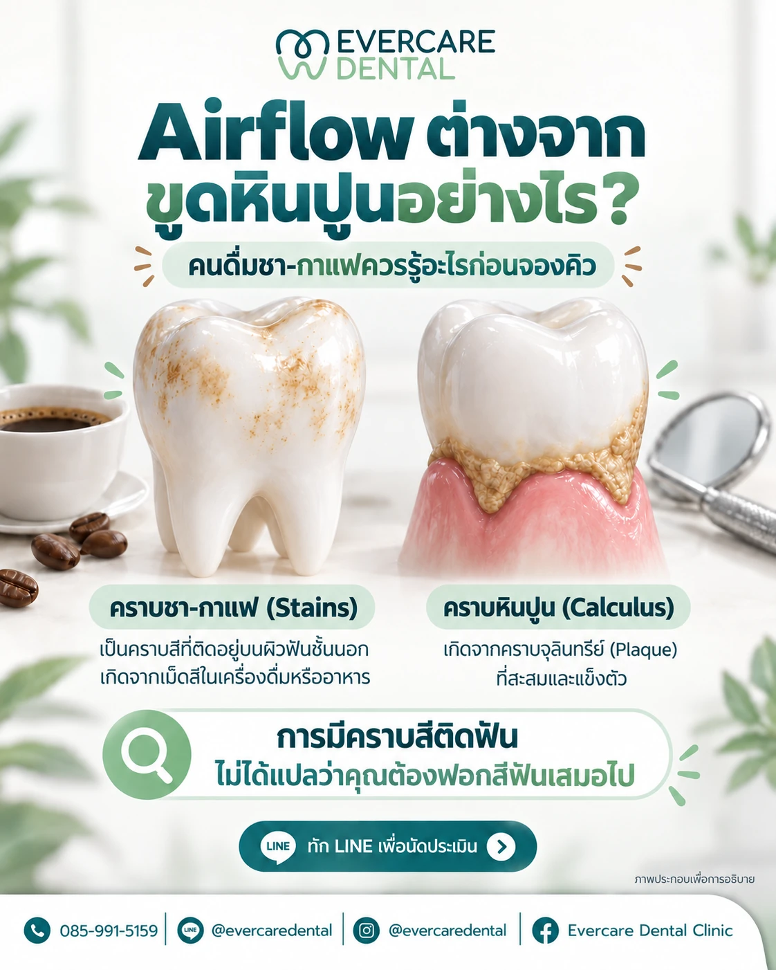Airflow ต่างจากขูดหินปูนอย่างไร เปรียบเทียบคราบชา-กาแฟและคราบหินปูน