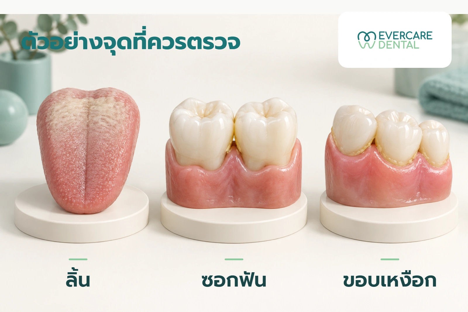 โมเดลจำลองสามชิ้นแสดงตัวอย่างบริเวณที่ทันตแพทย์อาจประเมิน ได้แก่ ลิ้น ซอกฟัน และขอบเหงือก ไม่ใช่ภาพผลรักษาหรือรายชื่อสาเหตุทั้งหมด
