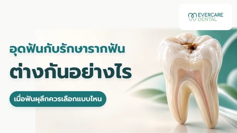อุดฟันกับรักษารากฟันต่างกันอย่างไร เมื่อฟันผุลึกควรเลือกแบบไหน อุดฟันกับรักษารากฟันต่างกันอย่างไร เมื่อฟันผุลึกควรเลือกแบบไหน พร้อมโมเดลฟันสมมติด้านขวา