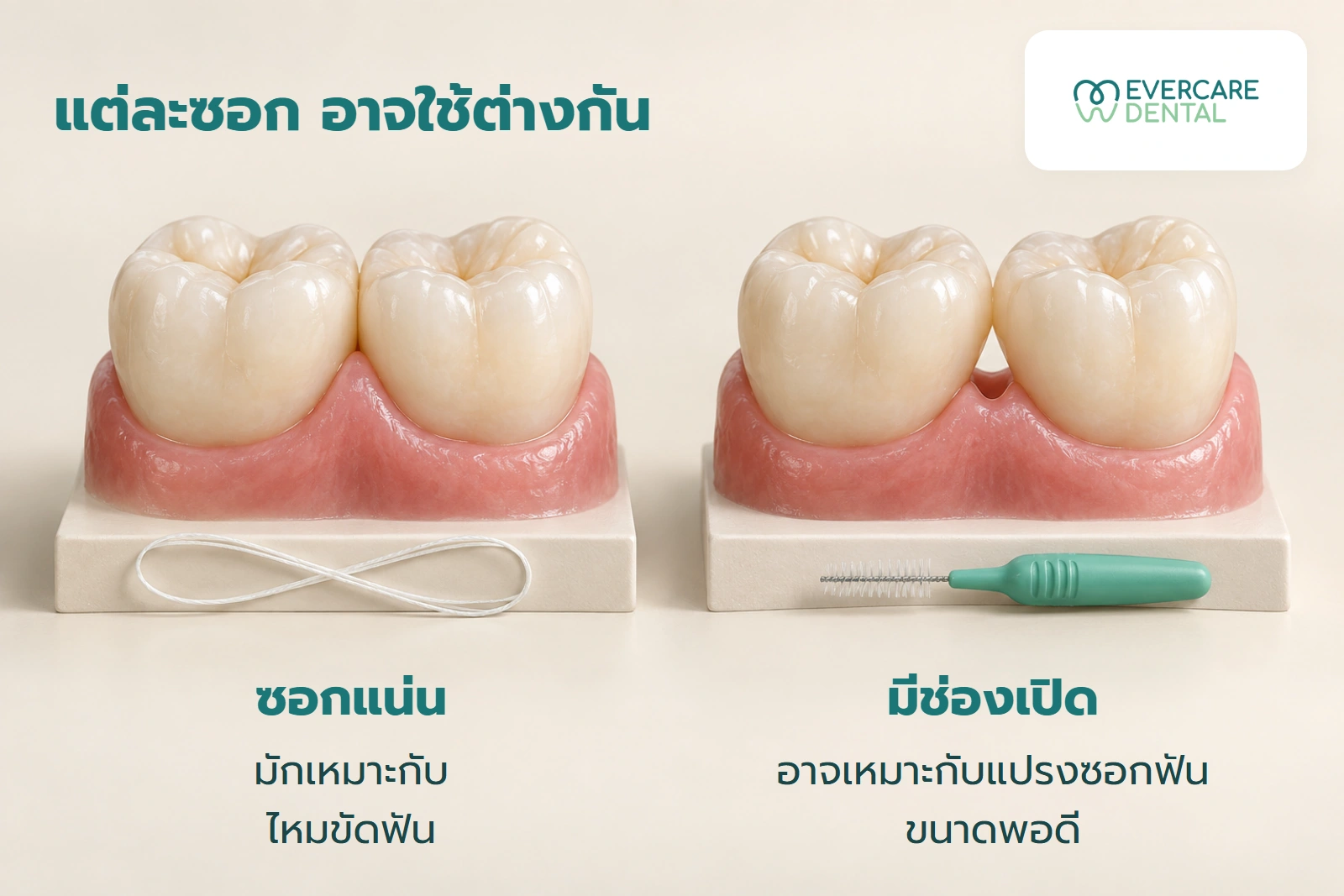 แบบจำลองแนวคิดแสดงซอกแน่นกับซอกที่มีช่องเปิด ไหมและแปรงวางแยกจากโมเดล ไม่ได้สาธิตวิธีใช้