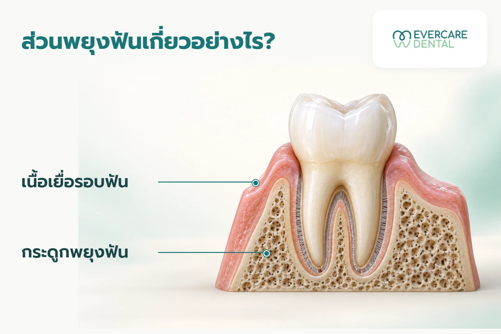 แบบจำลองฟันหนึ่งซี่ แสดงเนื้อเยื่อรอบฟันและกระดูกพยุงฟัน เป็นภาพประกอบ AI ไม่ใช่ภาพผู้ป่วย