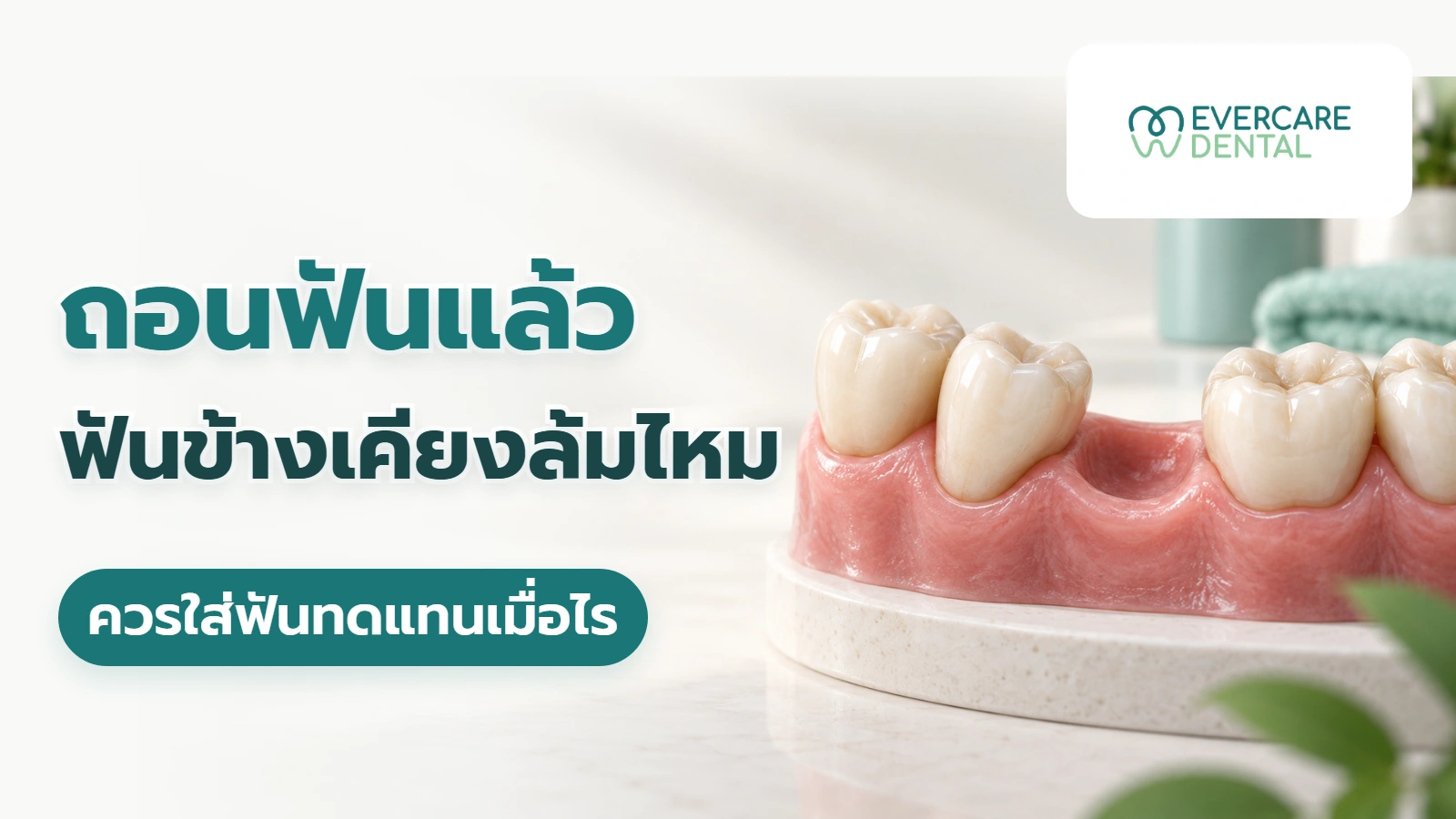 ถอนฟันแล้วฟันข้างเคียงล้มไหม ควรใส่ฟันทดแทนเมื่อไร