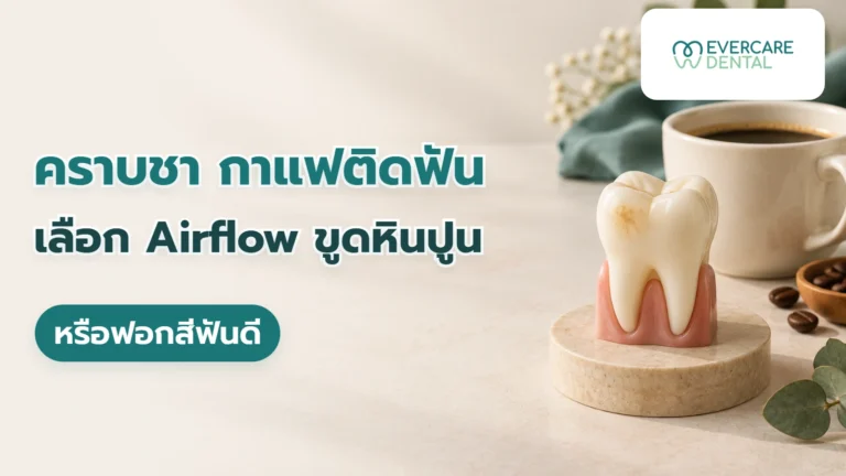 คราบชา กาแฟติดฟัน เลือก Airflow ขูดหินปูน หรือฟอกสีฟันดี แก้วกาแฟข้างโมเดลฟันสีงาช้างที่มีคราบผิวเล็กน้อย