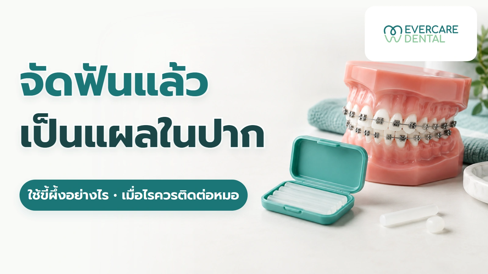 จัดฟันแล้วเป็นแผลในปาก ใช้ขี้ผึ้งจัดฟันอย่างไร