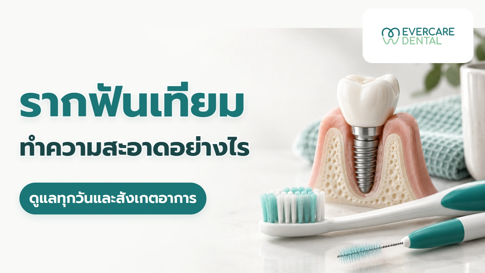 ทำความสะอาดรากฟันเทียมอย่างไร เลือกอุปกรณ์และดูแลซอกฟัน