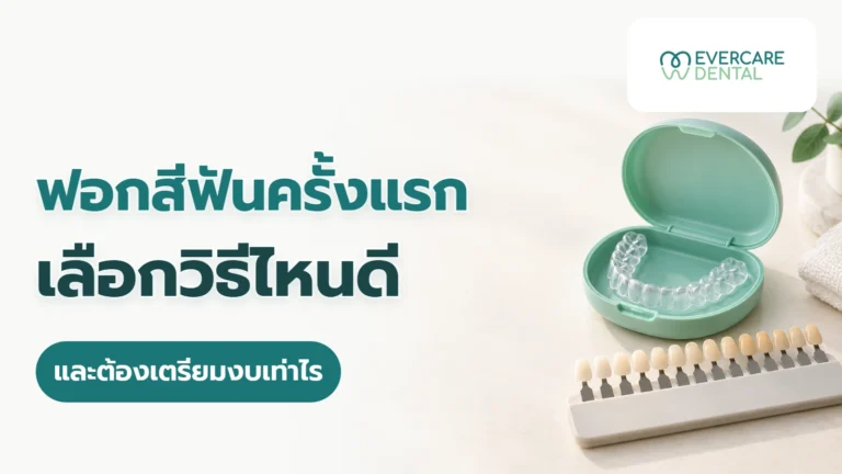 ฟอกสีฟันครั้งแรก เลือกวิธีไหนดี และต้องเตรียมงบเท่าไร ภาพประกอบแนวคิดถาดฟอกสีฟันใสในกล่องเปิดและแถบเทียบสีฟัน พร้อมหัวข้อฟอกสีฟันครั้งแรก เลือกวิธีไหนดี และต้องเตรียมงบเท่าไร