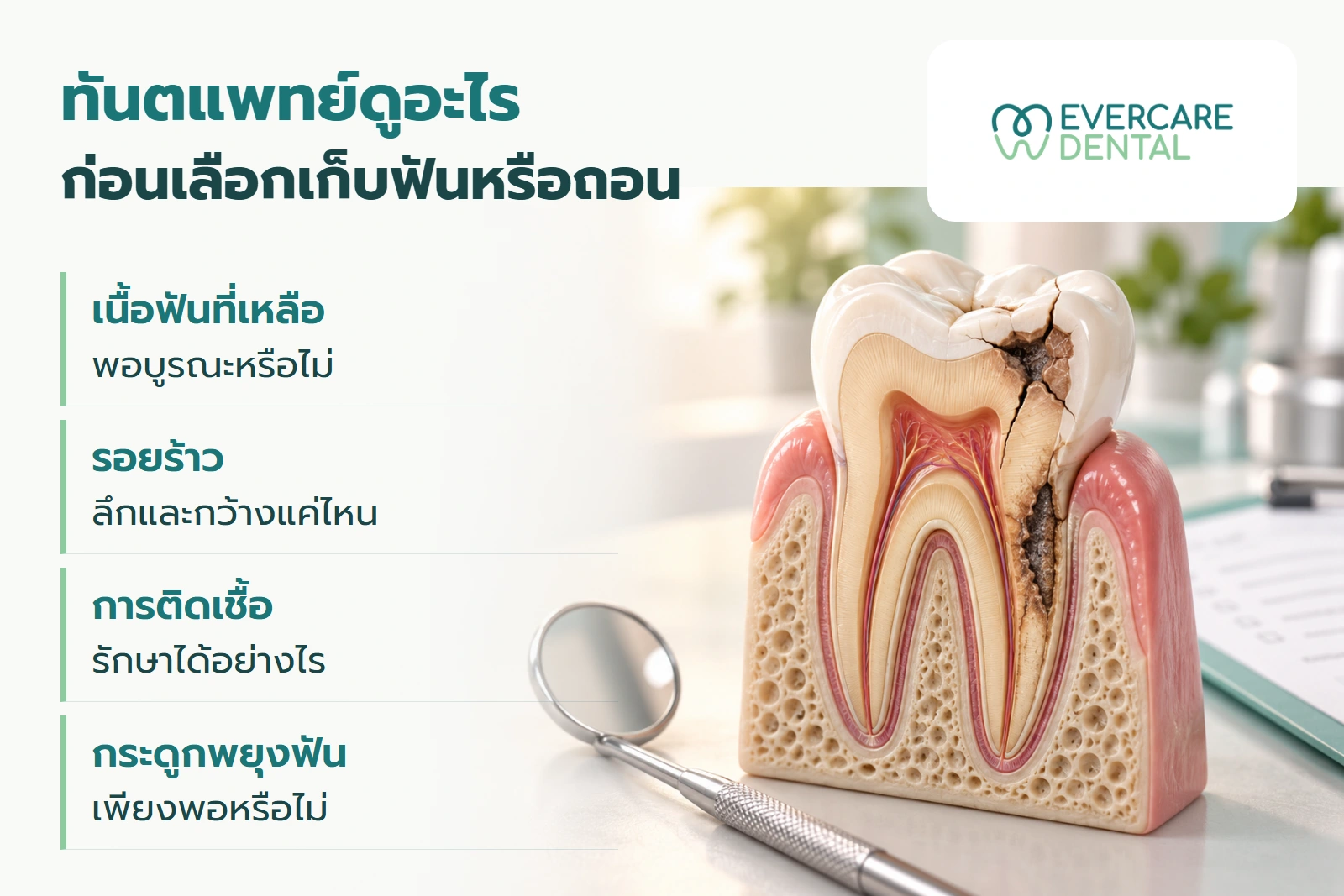 โมเดลฟันตัดขวางเชิงแนวคิดหนึ่งชิ้น ประกอบปัจจัยที่ทันตแพทย์ประเมิน ได้แก่ เนื้อฟัน รอยร้าว การติดเชื้อ และกระดูกพยุงฟัน ไม่ใช่ผลตรวจผู้ป่วย