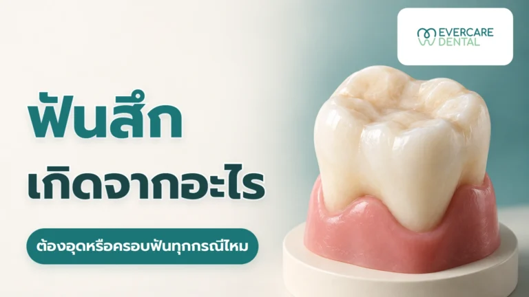 ฟันสึกเกิดจากอะไร ต้องอุดหรือครอบฟันทุกกรณีไหม โมเดลฟันกรามสามมิติจำลองบนฐาน ประกอบคำถามเรื่องสาเหตุฟันสึกและความจำเป็นในการอุดหรือครอบฟัน